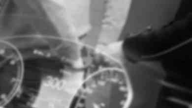 Quels sont les risques de rouler à 300 km/h ?